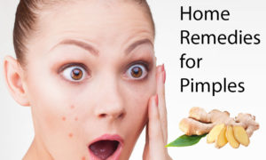 home remedies for pimples