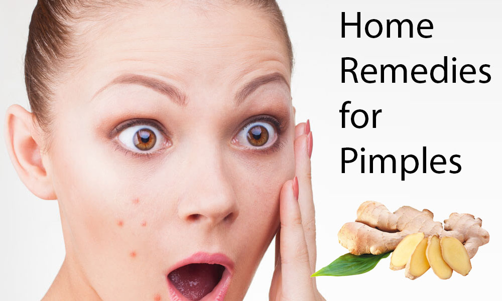 home remedies for pimples