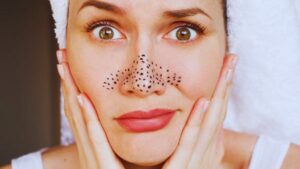Pores, Blackhead, Steam, Charcoal, Exfoliation