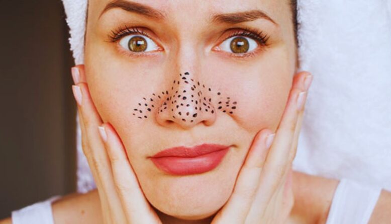Pores, Blackhead, Steam, Charcoal, Exfoliation