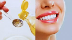 Bacteria, Oil Pulling, Bad Breath, Inflammation, Gum, Oral Hygiene