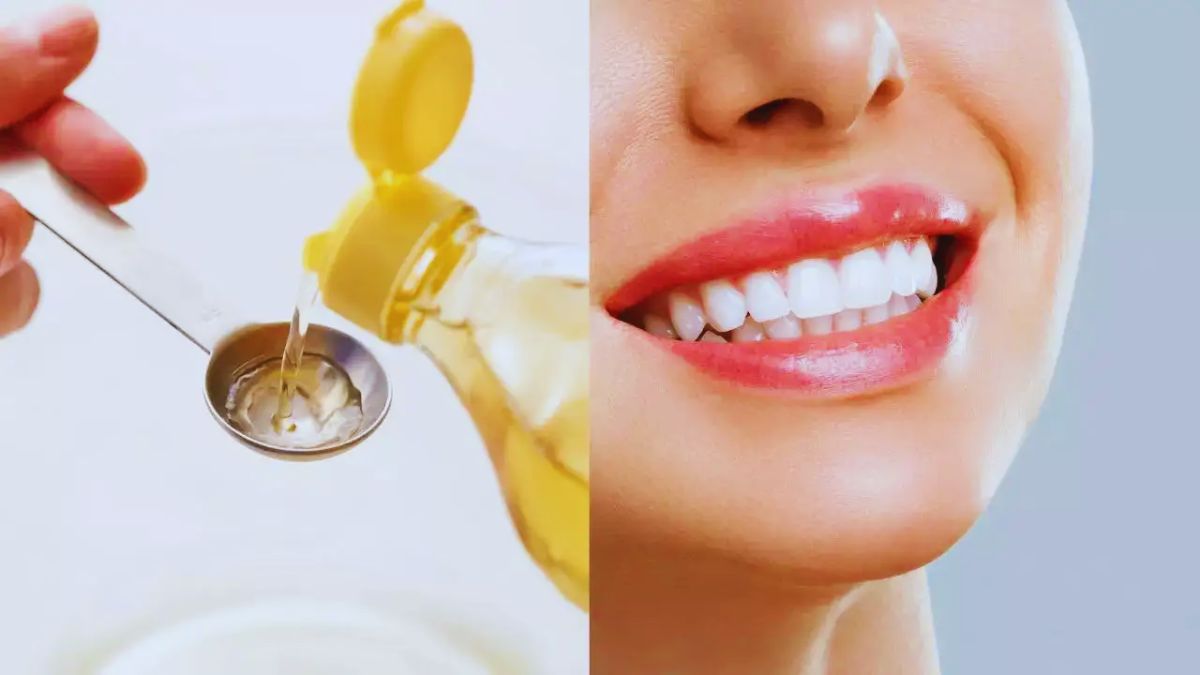 Bacteria, Oil Pulling, Bad Breath, Inflammation, Gum, Oral Hygiene