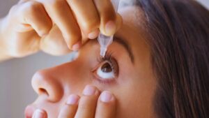 Vision, Eyes, Blur, Cornea, Swelling, Redness