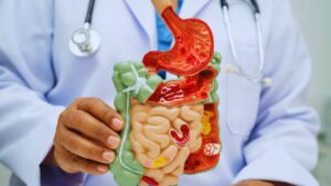 Raisin, Black, Golden, Weight Loss, Skin, Health