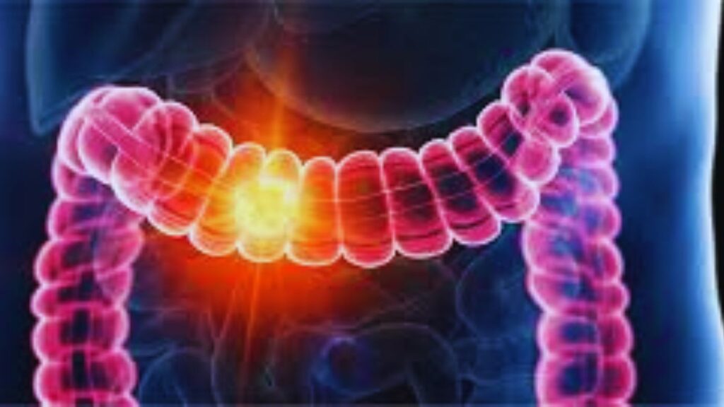 Diet, Colon Cancer, Liver, Gut Health
