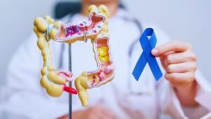 Diet, Colon Cancer, Liver, Gut Health