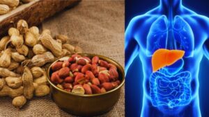 peanuts liver damage, aflatoxins in peanuts, liver health, peanut safety, peanut storage tips, aflatoxin poisoning, peanut contamination, liver cirrhosis, liver cancer risk, eating too many peanuts, peanut health benefits, peanut side effects, aflatoxin B1, peanut allergy, peanut nutrition