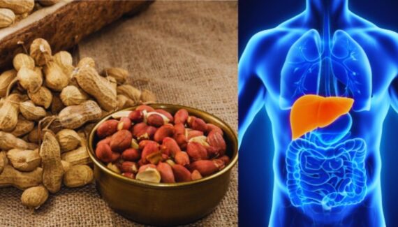 peanuts liver damage, aflatoxins in peanuts, liver health, peanut safety, peanut storage tips, aflatoxin poisoning, peanut contamination, liver cirrhosis, liver cancer risk, eating too many peanuts, peanut health benefits, peanut side effects, aflatoxin B1, peanut allergy, peanut nutrition