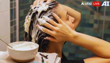 dandruff home remedies, natural dandruff treatment, how to remove dandruff naturally, dandruff cure at home, scalp health tips, lemon juice for dandruff, coconut oil for dandruff, aloe vera for scalp, baking soda dandruff remedy, apple cider vinegar for hair, fenugreek for dandruff, yogurt hair mask, neem leaves for dandruff, itchy scalp remedies, dry scalp treatment, natural hair care tips, antifungal hair remedies, dandruff control methods, home remedies for itchy scalp, natural scalp treatment, dandruff removal tips