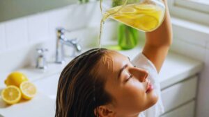 dandruff home remedies, natural dandruff treatment, how to remove dandruff naturally, dandruff cure at home, scalp health tips, lemon juice for dandruff, coconut oil for dandruff, aloe vera for scalp, baking soda dandruff remedy, apple cider vinegar for hair, fenugreek for dandruff, yogurt hair mask, neem leaves for dandruff, itchy scalp remedies, dry scalp treatment, natural hair care tips, antifungal hair remedies, dandruff control methods, home remedies for itchy scalp, natural scalp treatment, dandruff removal tips